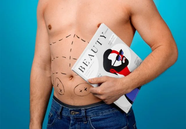 Liposuccion-en-hombres