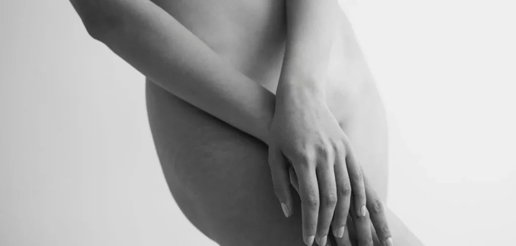 labioplastia postoperatorio
