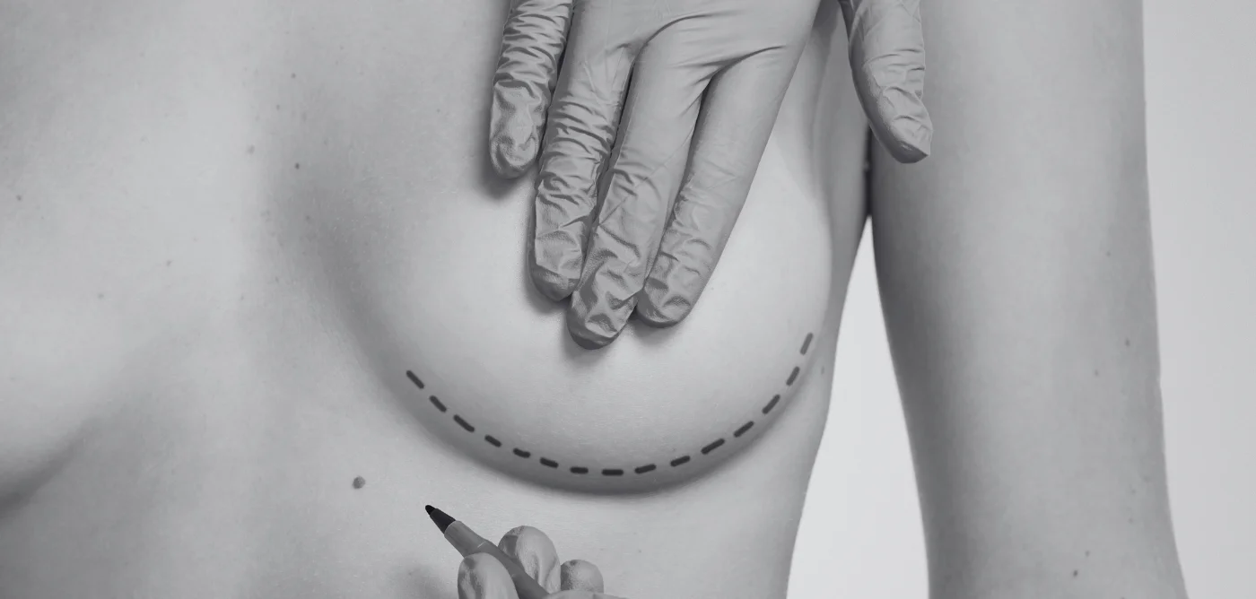 los mejores tratamientos de medicina estética