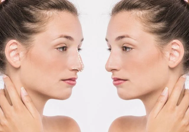 tipo de nariz para cada rostro