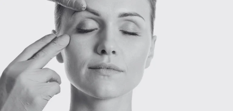 cicatrices blefaroplastia al mes