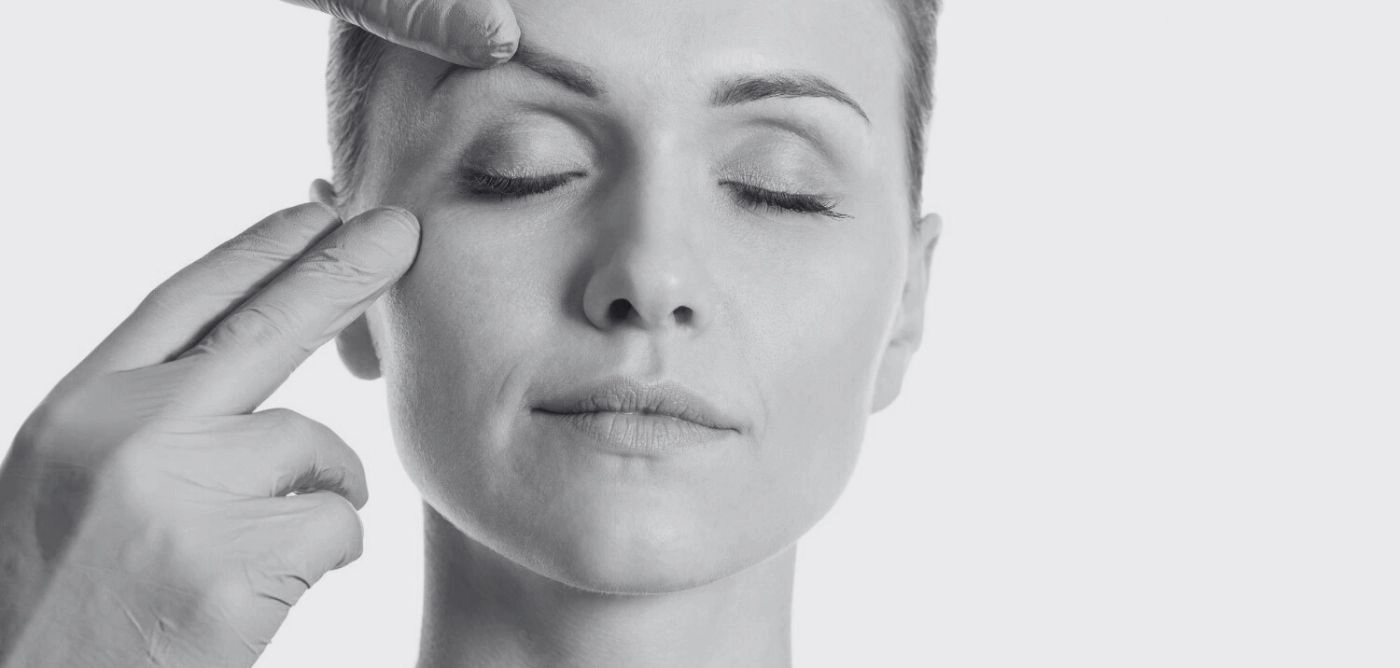 cicatrices blefaroplastia al mes