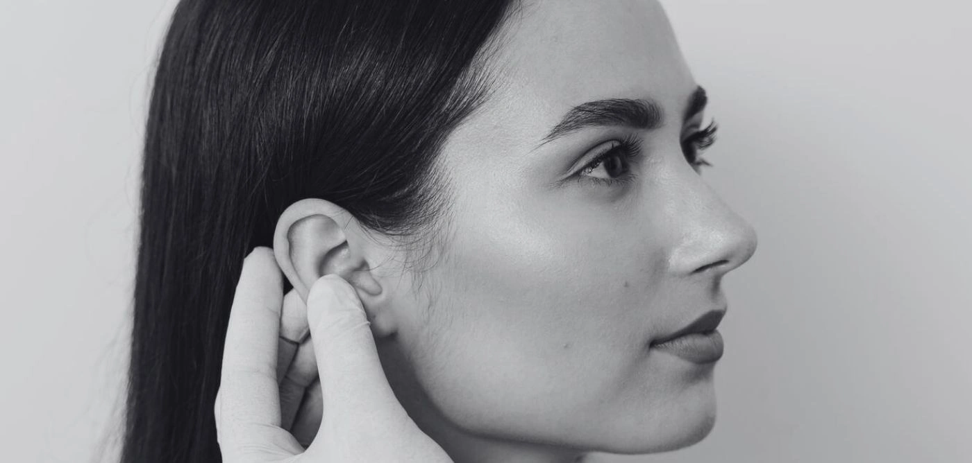 se despegan las orejas después de una otoplastia