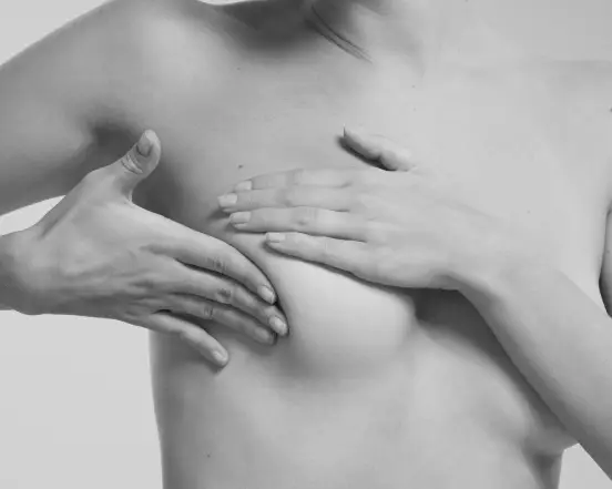 Mamas tuberosas Las Palmas