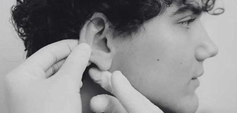 Postoperatorio de otoplastia