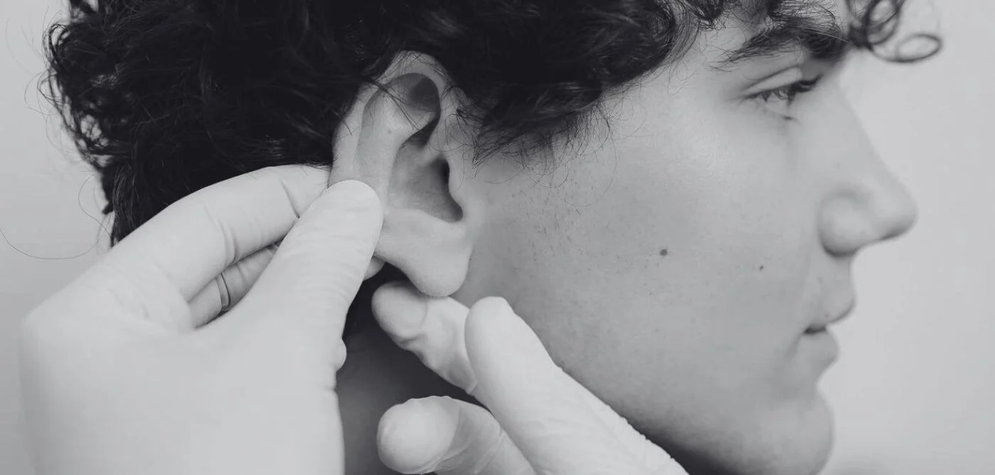 Postoperatorio de otoplastia