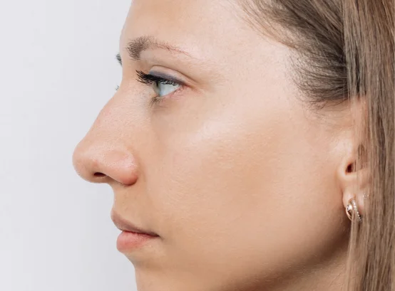 rinoplastia Tenerife