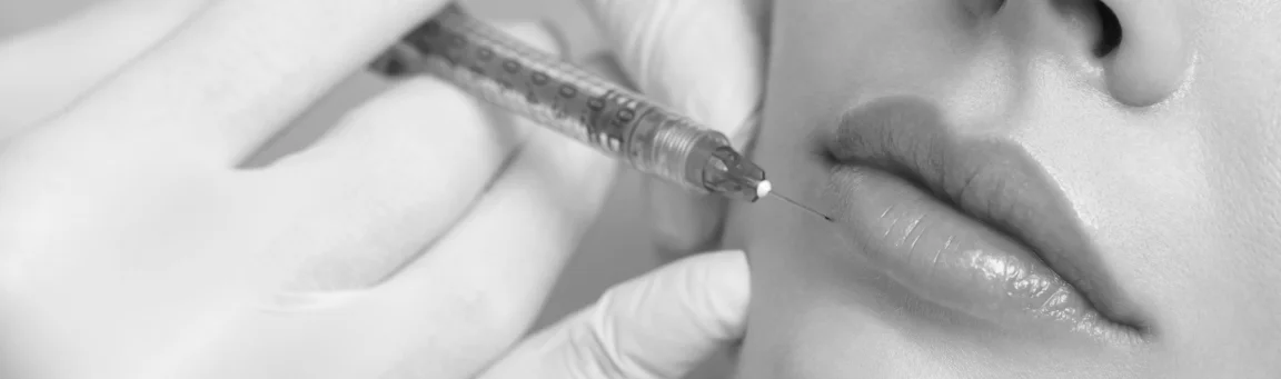 Clinica aumento de labios con fillers Tenerife