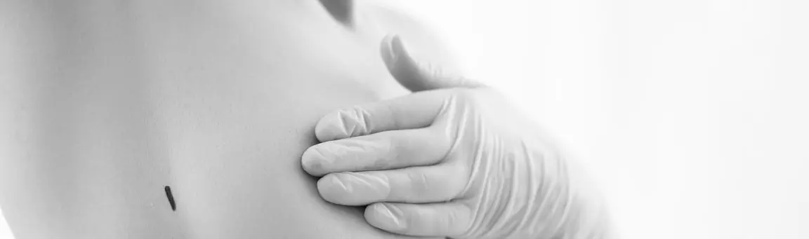 Mamoplastia tecnica minimamente invasiva Tenerife