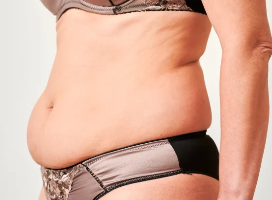 liposuccion Tenerife