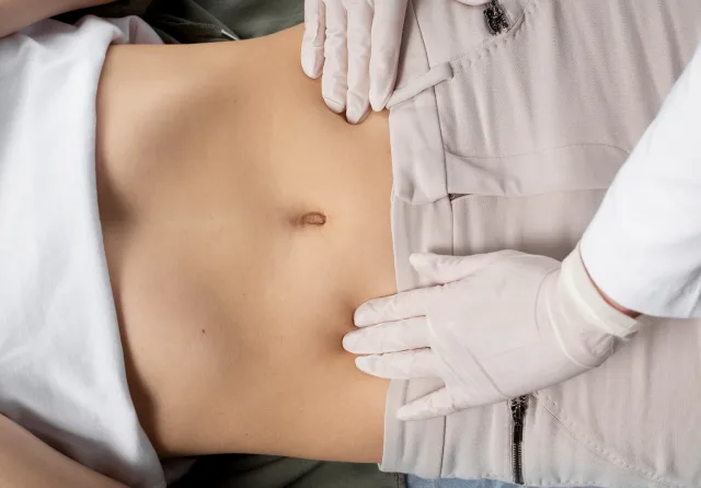 miniabdominoplastia