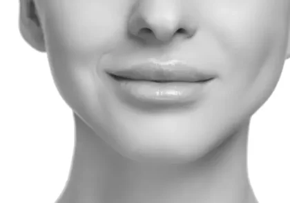 Bichectomia Tenerife