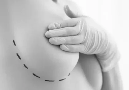 Mamoplastia tecnica AMI Tenerife