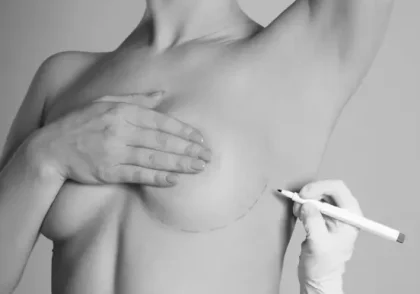 Mamoplastia tecnica hibrida Tenerife