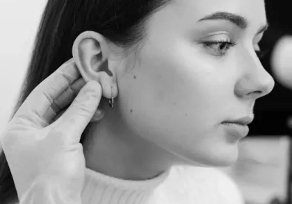 Otoplastia Tenerife