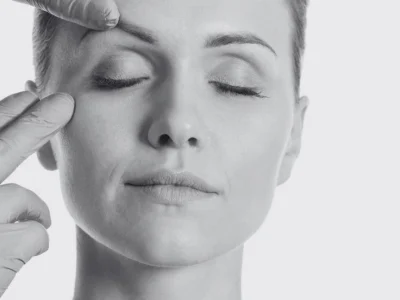 cicatrices blefaroplastia al mes