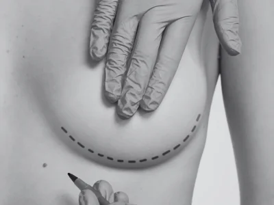 los mejores tratamientos de medicina estética