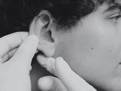 Postoperatorio de otoplastia