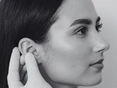 se despegan las orejas después de una otoplastia