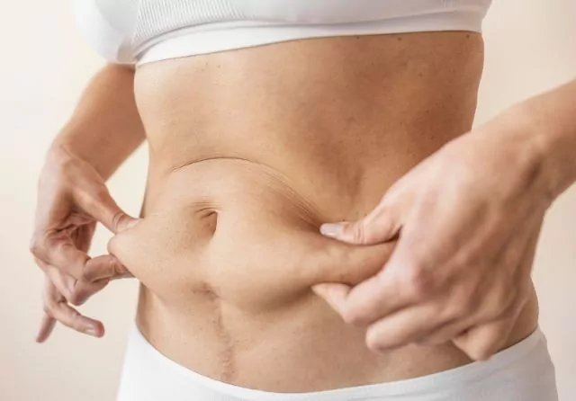 liposuccion de abdomen