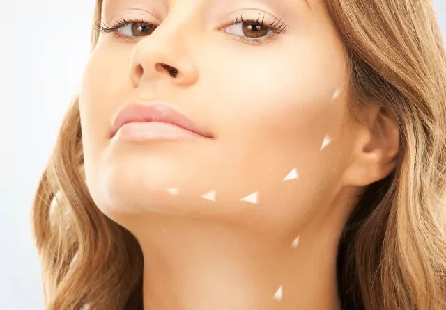 Bichectomia tecnica de adelgazamiento facial